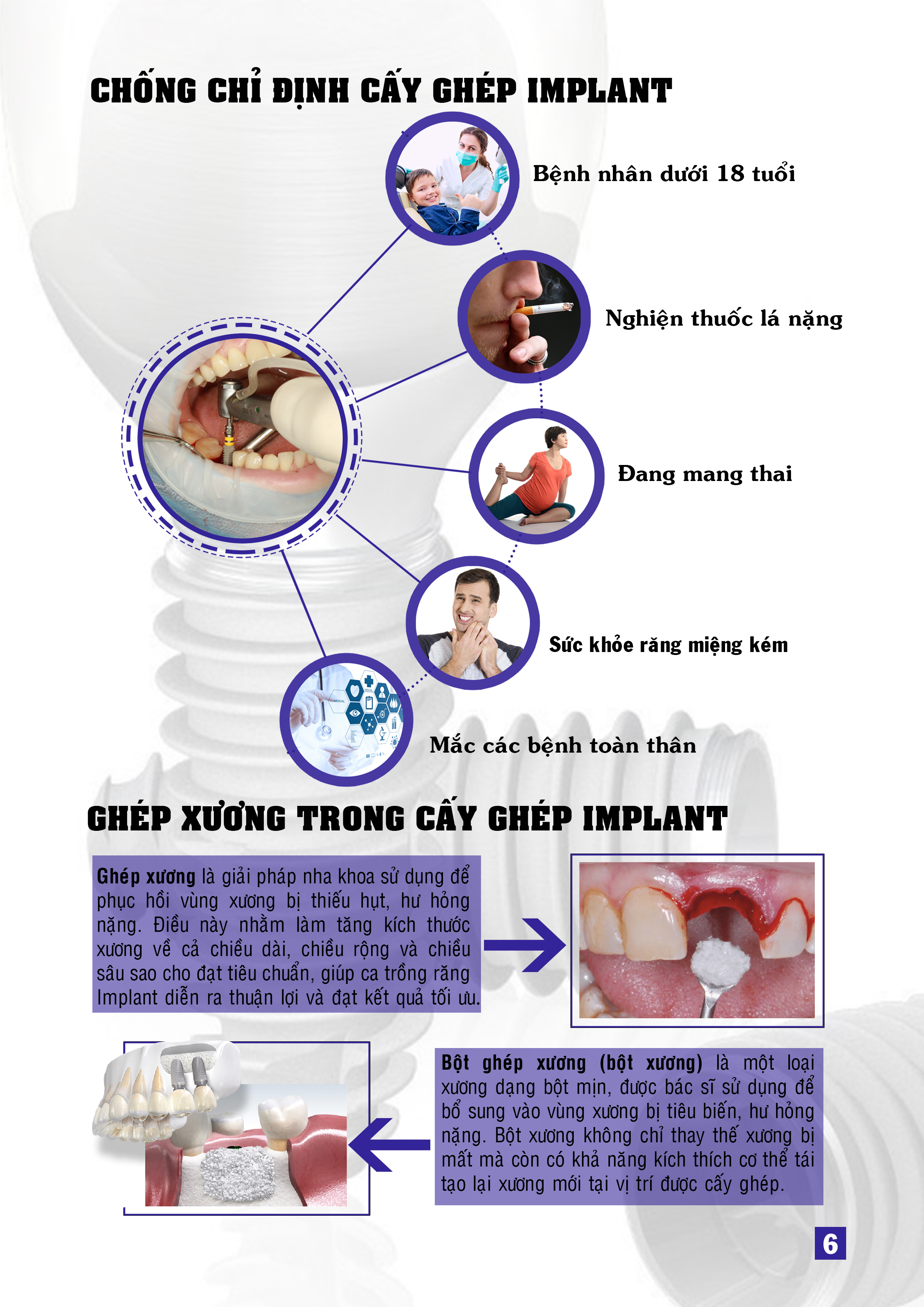 6. Chong chi dinh Implant.jpg